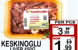 Keskinoglu كبد